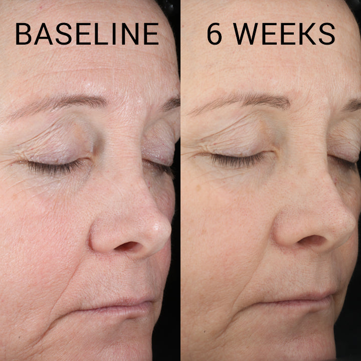 Fractionated Hyaluronic Acid Hydrating Serum